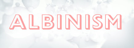Albinism in Your&nbsp;Skin
